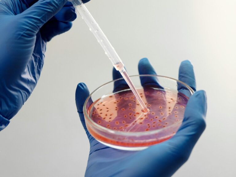 Universal Specimen Transport Medium for Microbes: Sample Preservation